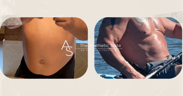 semaglutide for weight loss cypress tx Feeling overwhelmed by all the